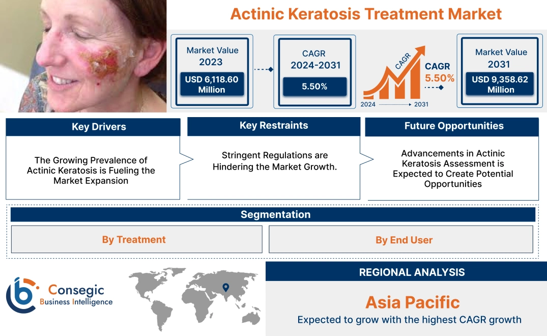 Actinic Keratosis Treatment Market