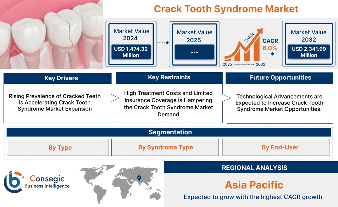 Crack Tooth Syndrome Market