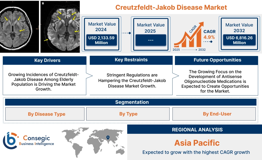 Creutzfeldt-Jakob Disease Market