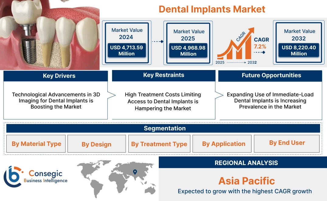 Dental Implants Market