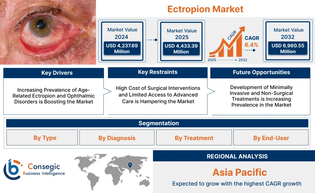 Ectropion Market