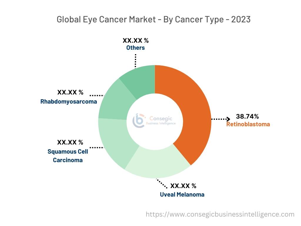 Eye Cancer Market By Type