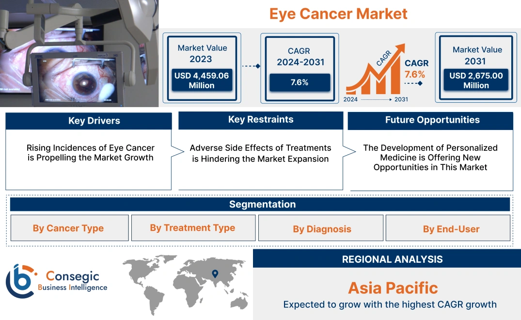 Eye Cancer Market