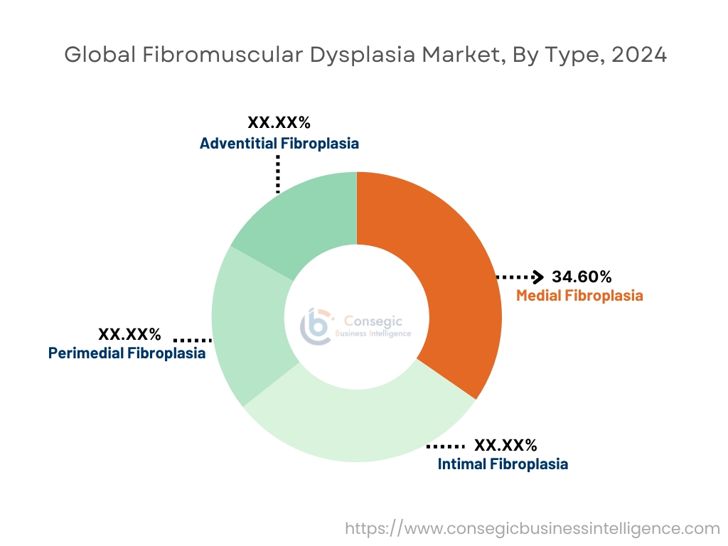 Fibromuscular Dysplasia Market By Type