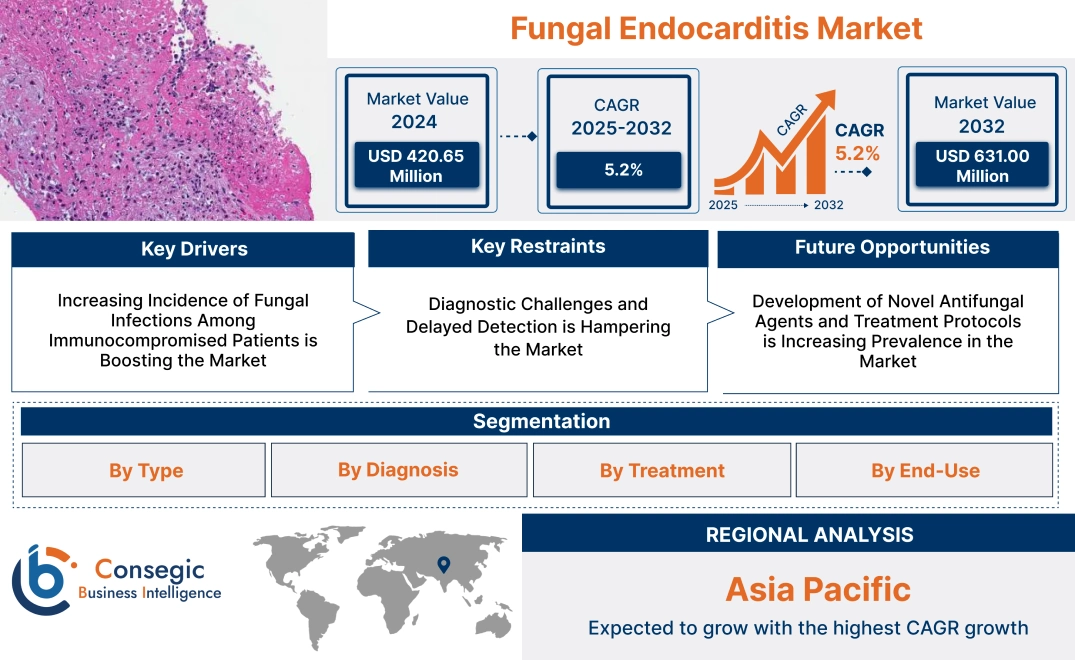 Fungal Endocarditis Market 