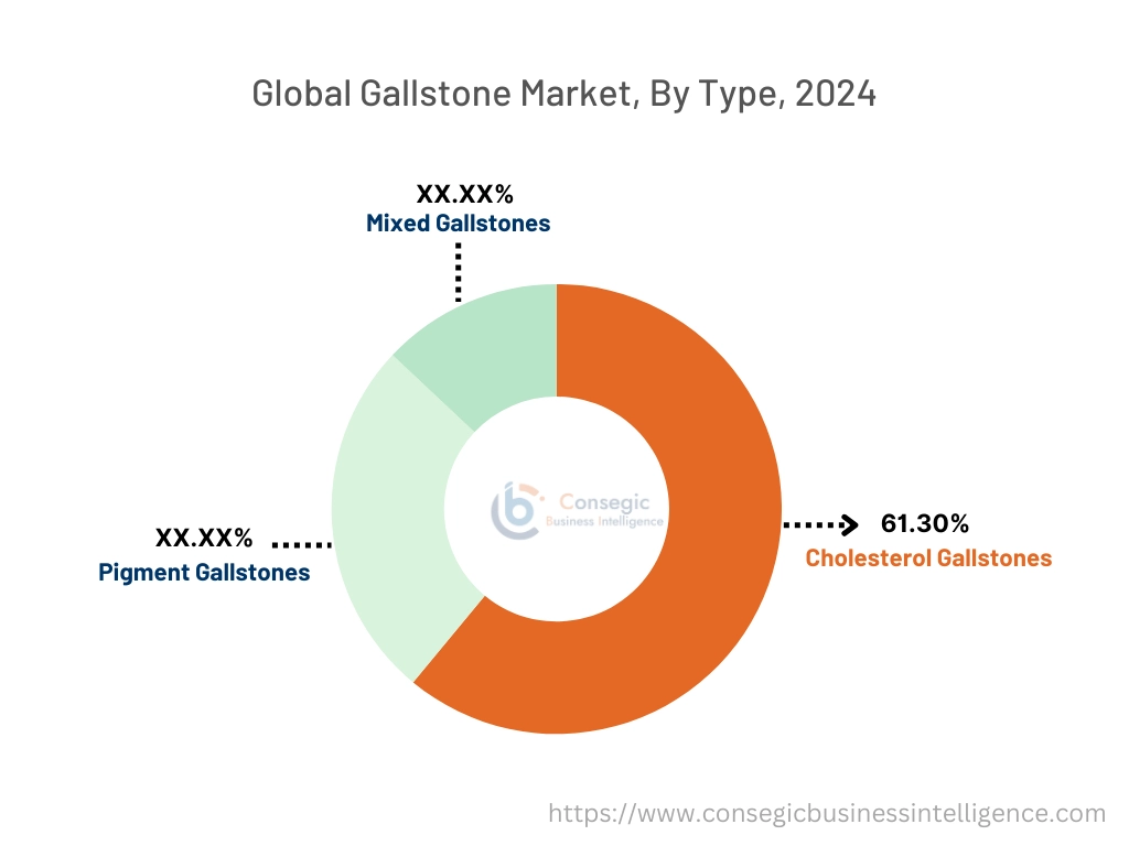 Gallstone Market By Type