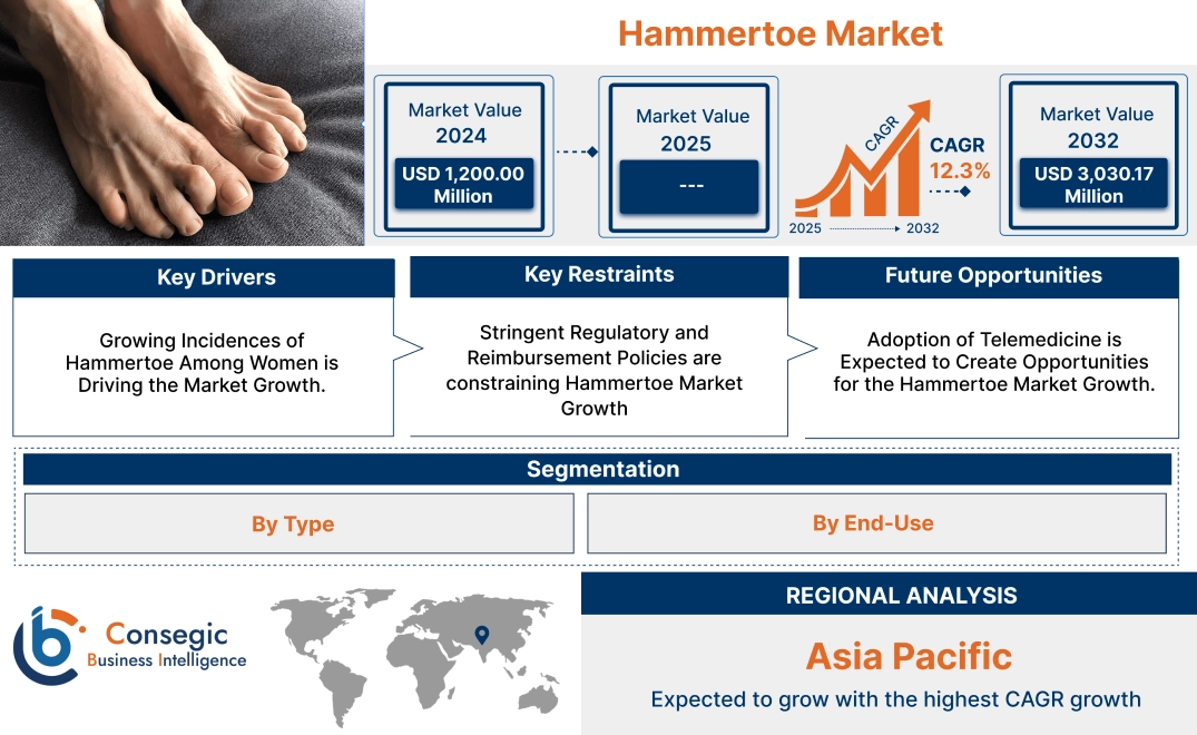 Hammertoe Market